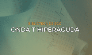 Leia mais sobre o artigo Onda T hiperaguda