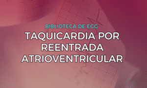 Leia mais sobre o artigo Taquicardia por Reentrada Atrioventricular