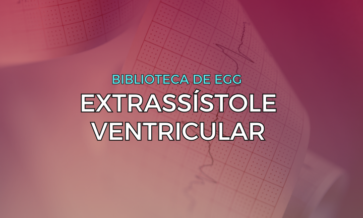 Leia mais sobre o artigo Extrassístole Ventricular