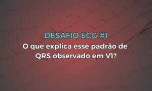 Leia mais sobre o artigo Desafio ECG #1: O que explica esse padrão de QRS observado em V1?