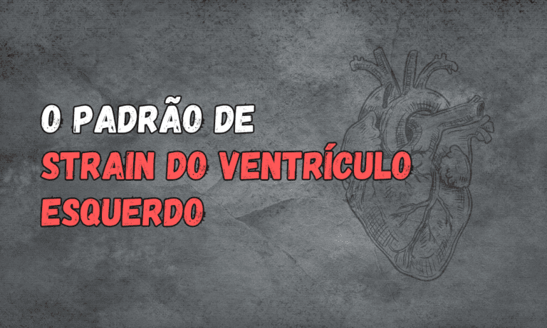 Leia mais sobre o artigo Entendendo o Padrão de ‘Strain’ do Ventrículo Esquerdo: Diagnóstico e Implicações Clínicas