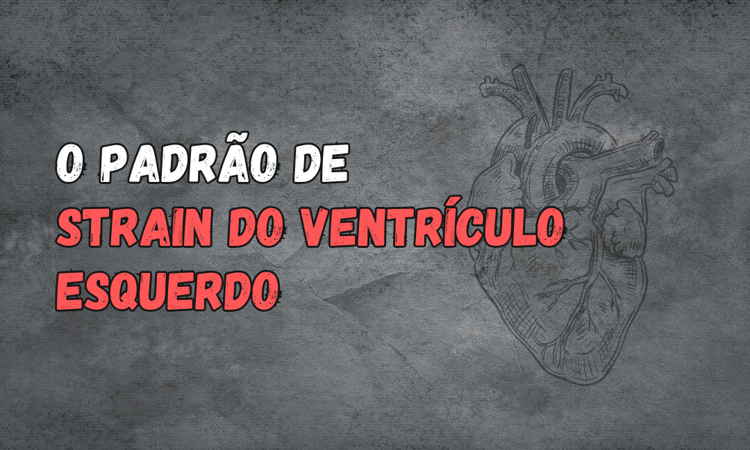 No momento, você está visualizando Entendendo o Padrão de ‘Strain’ do Ventrículo Esquerdo: Diagnóstico e Implicações Clínicas