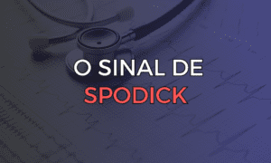 Leia mais sobre o artigo O Sinal de Spodick