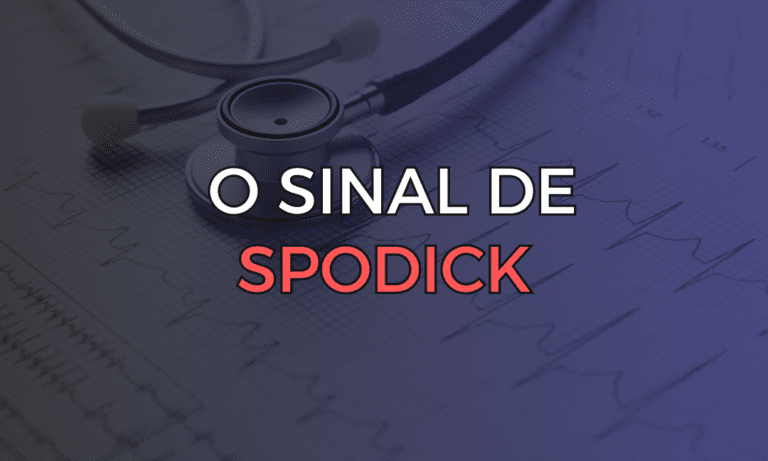 Leia mais sobre o artigo O Sinal de Spodick