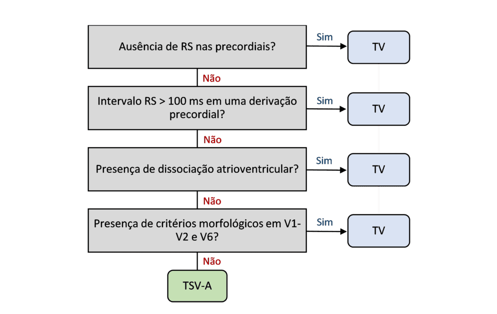 Algoritmo de Brugada para o diagnóstico diferencial entre taquicardia ventricular e taquicardia supraventricular com aberrância de condução