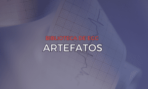 Leia mais sobre o artigo Artefatos