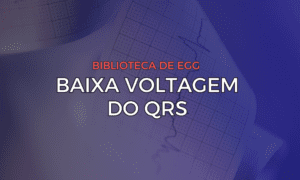 Leia mais sobre o artigo Baixa Voltagem do QRS