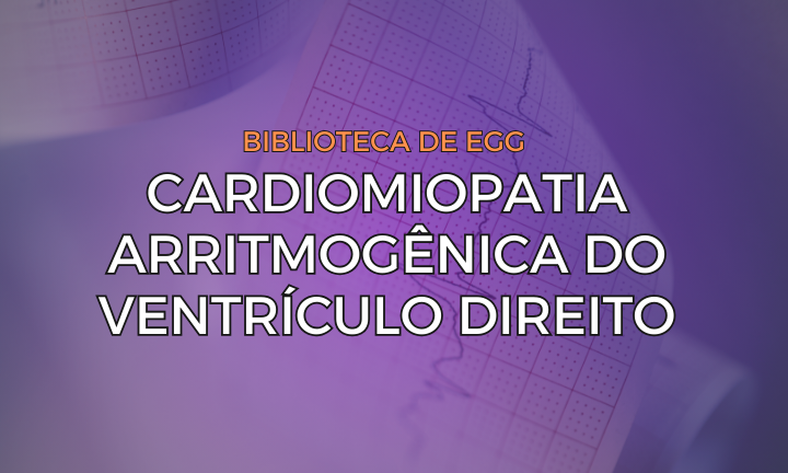 Leia mais sobre o artigo Cardiomiopatia Arritmogênica do Ventrículo Direito