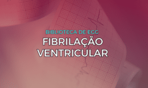 Leia mais sobre o artigo Fibrilação Ventricular