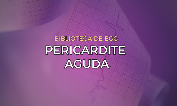 Leia mais sobre o artigo Pericardite Aguda