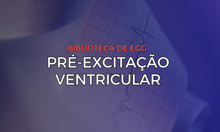 Leia mais sobre o artigo Pré-excitação Ventricular