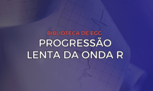 Leia mais sobre o artigo Progressão Lenta da Onda R