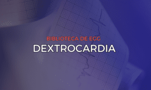 Leia mais sobre o artigo Dextrocardia