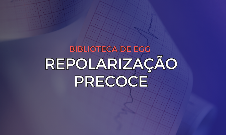 Leia mais sobre o artigo Padrão de Repolarização Precoce