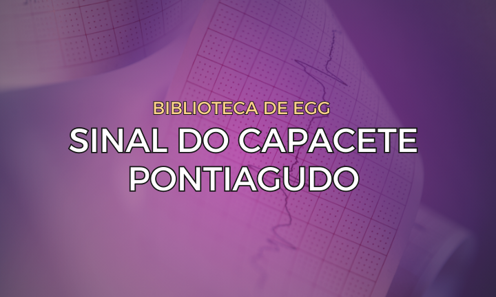 Leia mais sobre o artigo Sinal do Capacete Pontiagudo