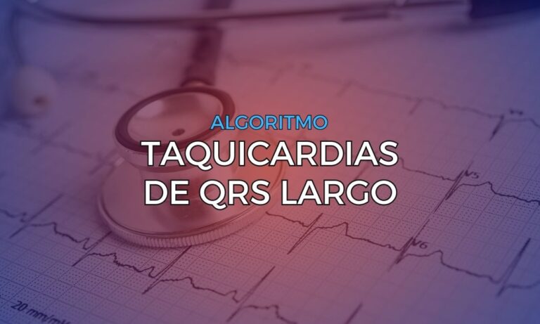 Leia mais sobre o artigo Algoritmos das Taquicardias de QRS Largo