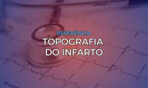 Leia mais sobre o artigo Topografia do Infarto