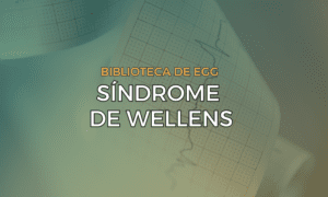 Leia mais sobre o artigo Síndrome de Wellens