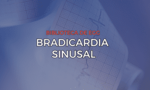 Leia mais sobre o artigo Bradicardia Sinusal