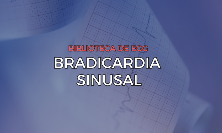 Leia mais sobre o artigo Bradicardia Sinusal