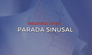 Leia mais sobre o artigo Parada Sinusal