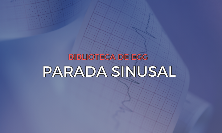 Leia mais sobre o artigo Parada Sinusal