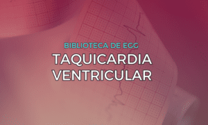 Leia mais sobre o artigo Taquicardia Ventricular