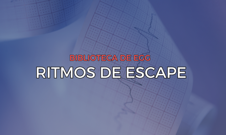 Leia mais sobre o artigo Ritmos de Escape