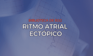 Leia mais sobre o artigo Ritmo Atrial Ectópico