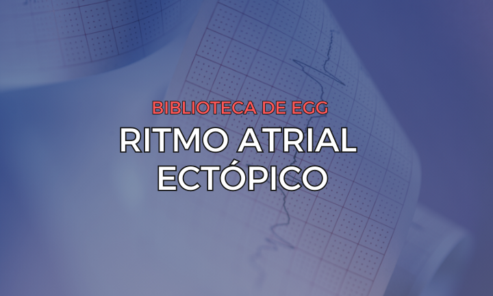 Leia mais sobre o artigo Ritmo Atrial Ectópico