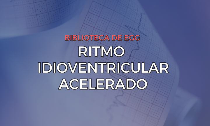 Leia mais sobre o artigo Ritmo Idioventricular Acelerado