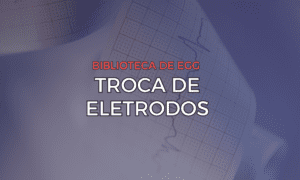 Leia mais sobre o artigo Trocas de Eletrodos