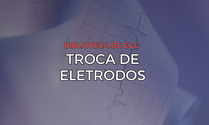 Leia mais sobre o artigo Trocas de Eletrodos