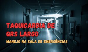 Leia mais sobre o artigo Manejo de Taquicardias de Complexo QRS Alargado na Sala de Emergência: O que Realmente Importa