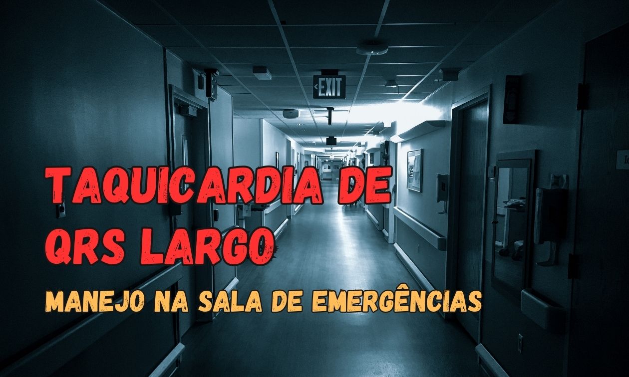 No momento, você está visualizando Manejo de Taquicardias de Complexo QRS Alargado na Sala de Emergência: O que Realmente Importa