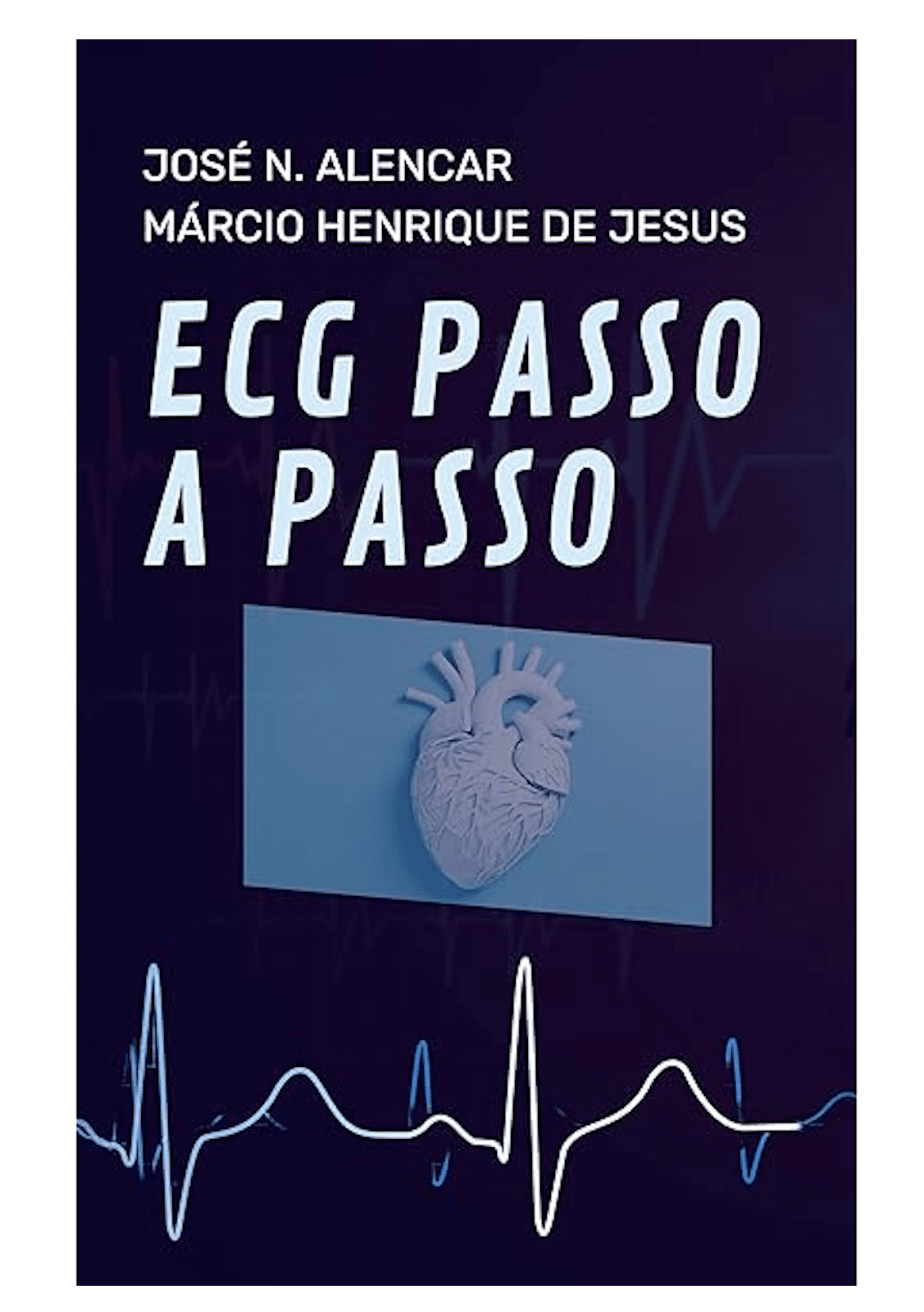 Livro ECG Passo a Passo