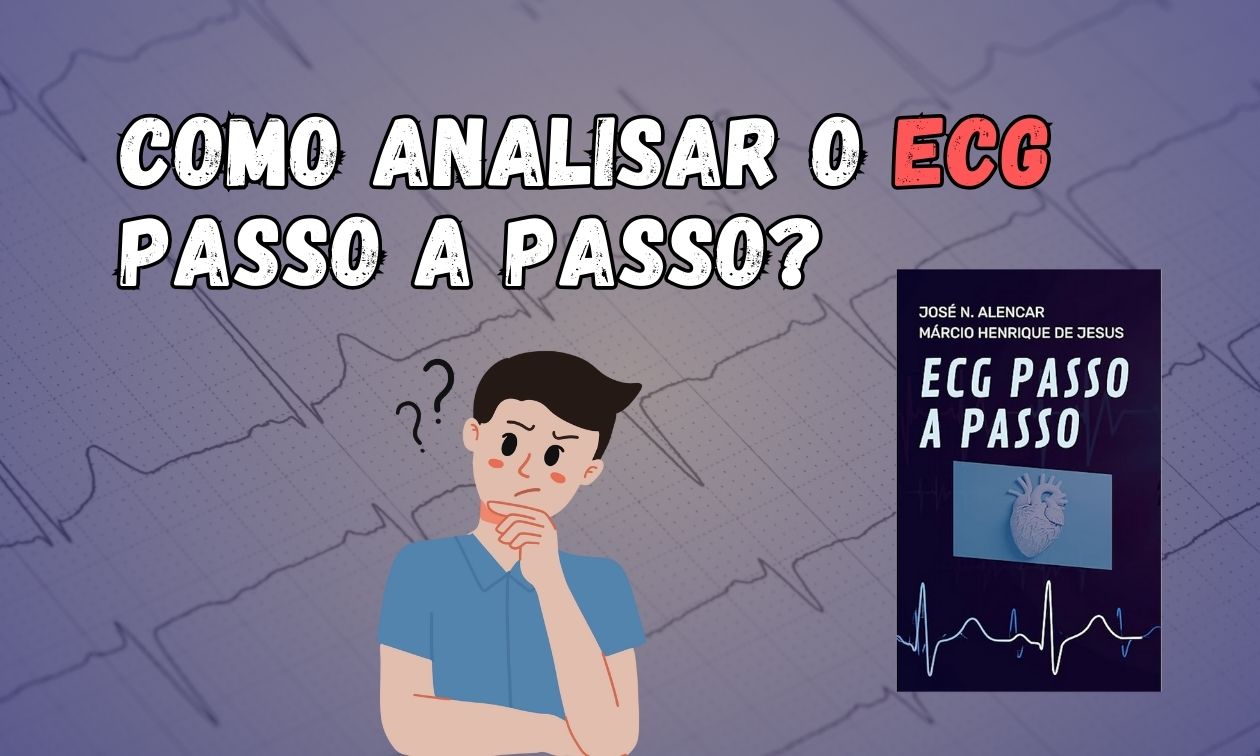 No momento, você está visualizando Como Analisar o ECG Passo-a-Passo