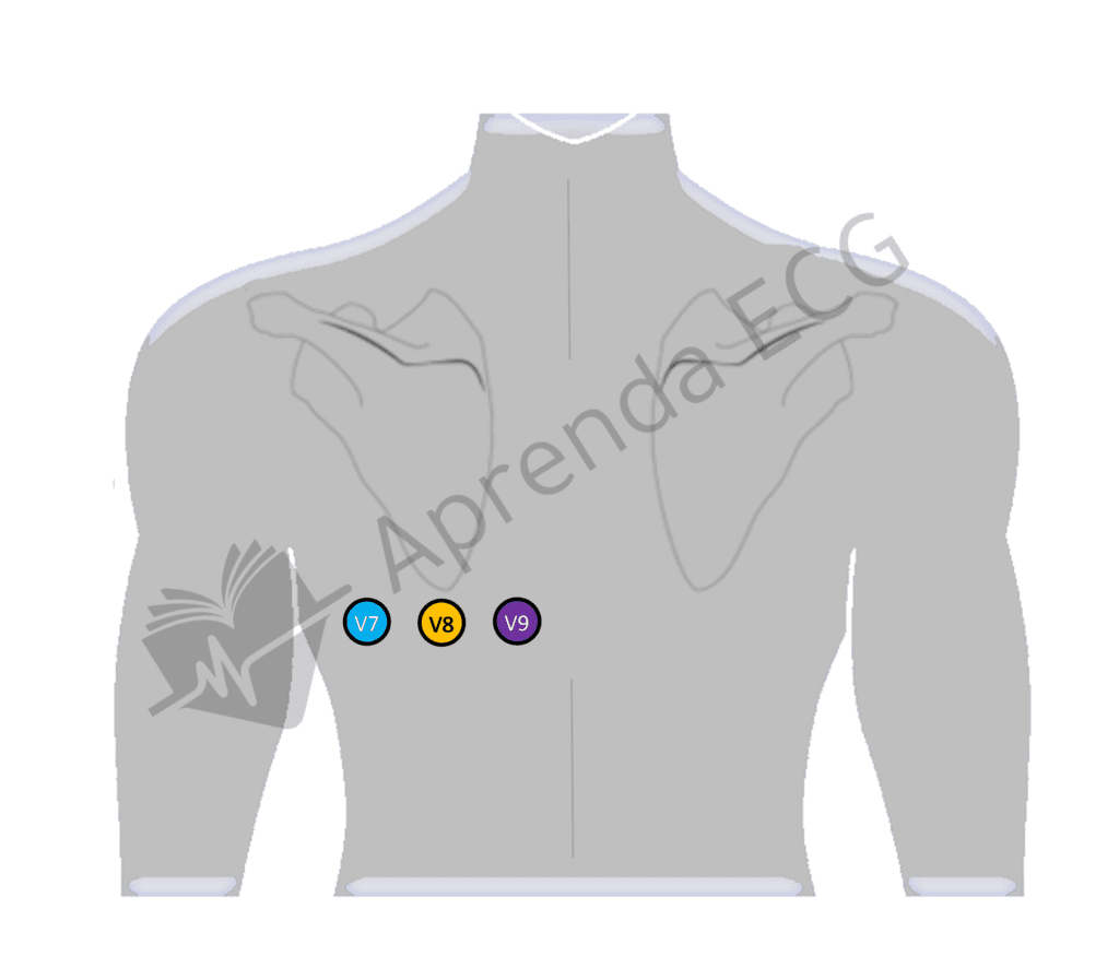 Derivações eletrocardiográfica V7, V8 e V9