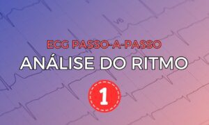 Leia mais sobre o artigo ECG Passo-a-Passo: Análise do Ritmo
