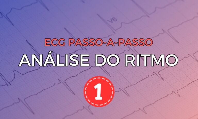Leia mais sobre o artigo ECG Passo-a-Passo: Análise do Ritmo