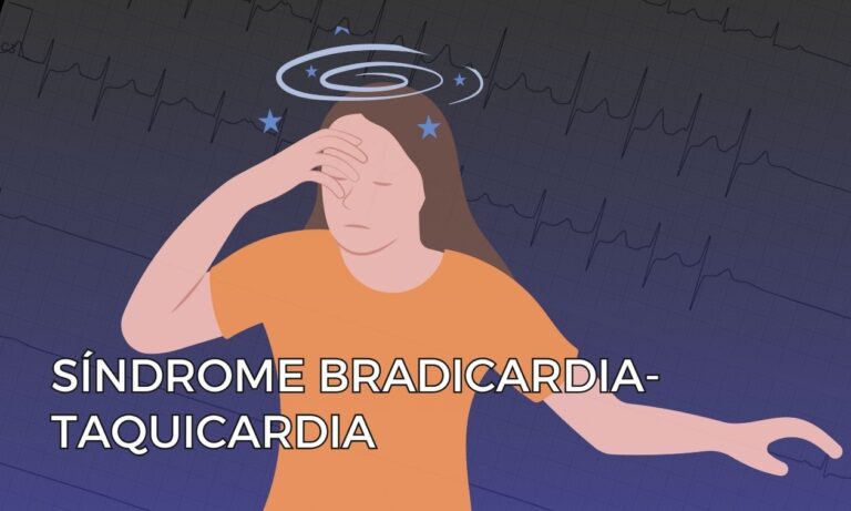 Leia mais sobre o artigo Síndrome Bradicardia-Taquicardia: Uma Visão Geral