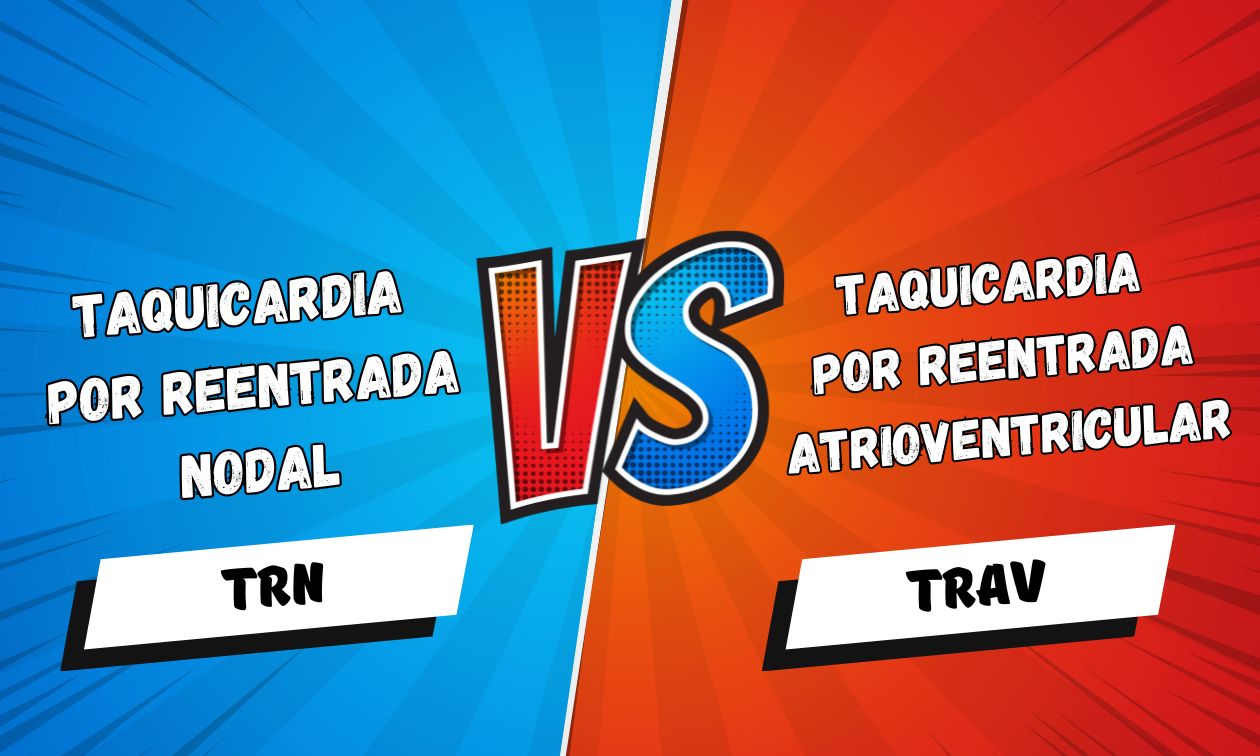 No momento, você está visualizando Taquicardia por Reentrada Nodal vs Taquicardia por Reentrada Atrioventricular Ortodrômica