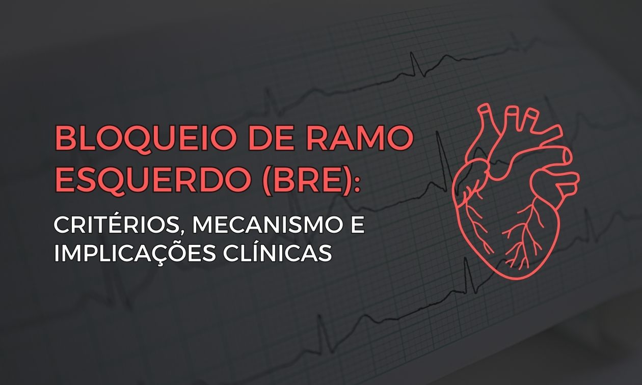 No momento, você está visualizando Bloqueio de Ramo Esquerdo: Critérios, Mecanismo e Implicações Clínicas
