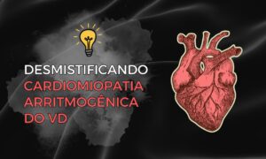 Leia mais sobre o artigo Desmistificando a Cardiomiopatia Arritmogênica do Ventrículo Direito