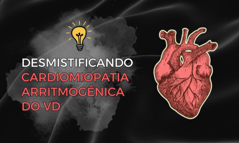 Leia mais sobre o artigo Desmistificando a Cardiomiopatia Arritmogênica do Ventrículo Direito