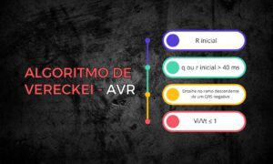 Leia mais sobre o artigo Como aplicar o algoritmo de Vereckei para diagnóstico das taquicardias de QRS largo