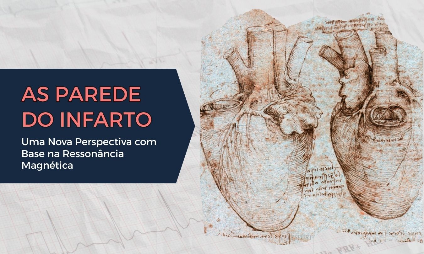 No momento, você está visualizando As Paredes do Infarto: Uma Nova Perspectiva com Base na Ressonância Magnética