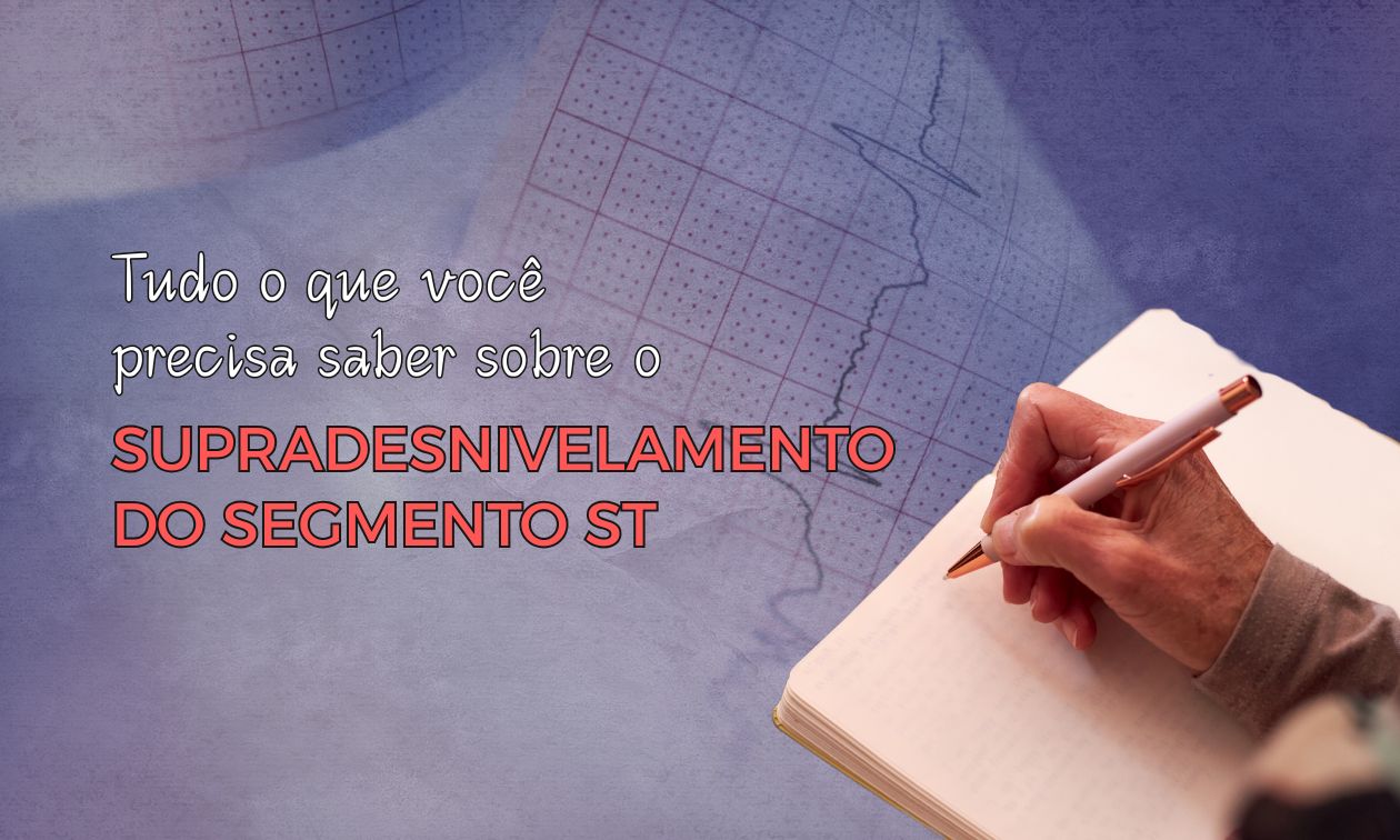 No momento, você está visualizando Tudo que Você Precisa Saber sobre o Supradesnivelamento do Segmento ST