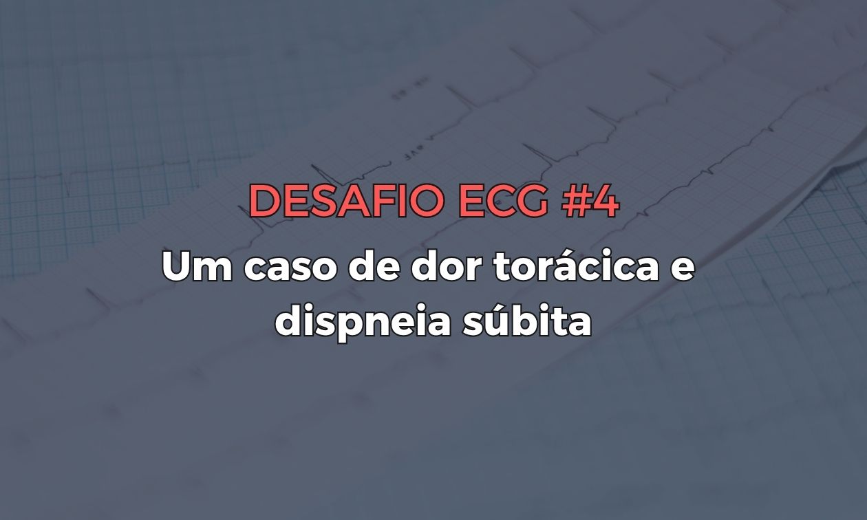 No momento, você está visualizando Desafio ECG #4: Um caso de dor torácica e dispneia súbita