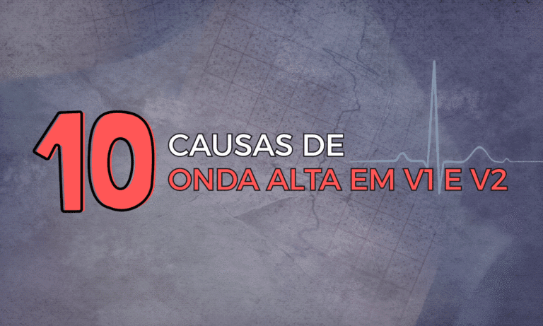 Leia mais sobre o artigo 10 Causas de Onda R Alta em V1 e V2